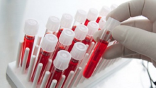 Общие правила сдачи анализа крови